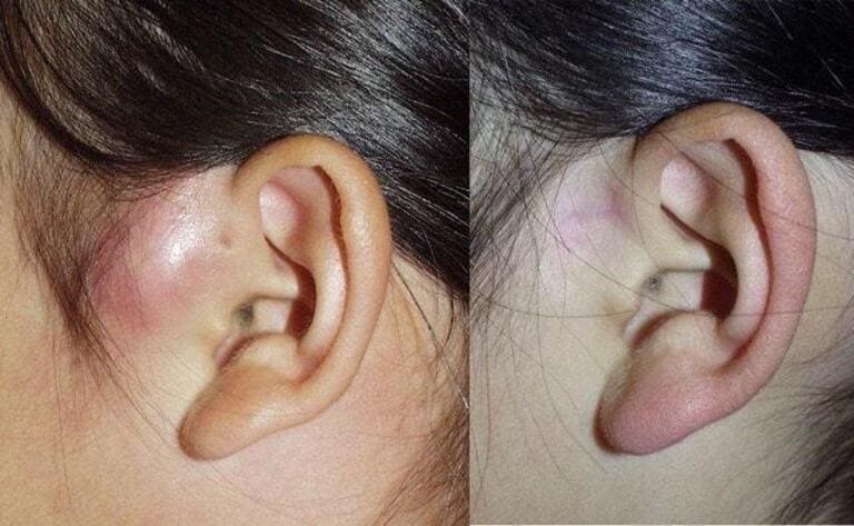 耳の形成術 立ち耳 副耳等 眼瞼下垂なら相模原市 橋本駅の形成外科 美容外科 美容皮膚科 なでしこクリニックへ